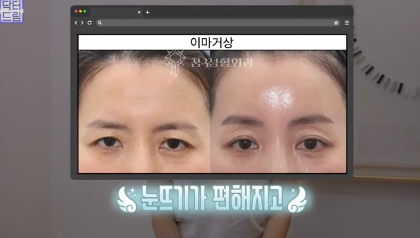 평생 딱 한번만 할 수 있는 수술 사진 4