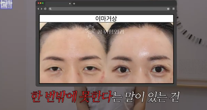 평생 딱 한번만 할 수 있는 수술 사진 10
