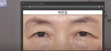평생 딱 한번만 할 수 있는 수술 사진 15