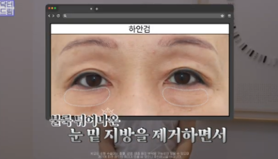 평생 딱 한번만 할 수 있는 수술 사진 2
