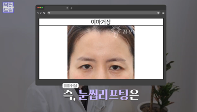 40대를 기준으로 얼굴에도 노후계획이 필요합니다 사진 21