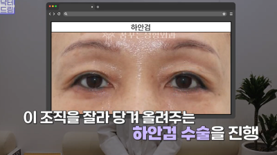 40대를 기준으로 얼굴에도 노후계획이 필요합니다 사진 6