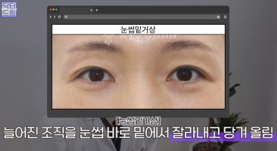 40대를 기준으로 얼굴에도 노후계획이 필요합니다 사진 16