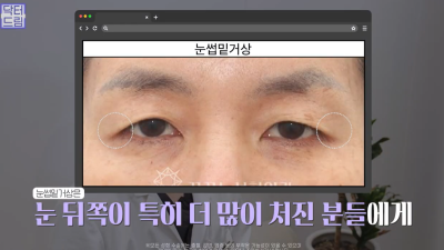 40대를 기준으로 얼굴에도 노후계획이 필요합니다 사진 17
