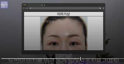 40대를 기준으로 얼굴에도 노후계획이 필요합니다 사진 20