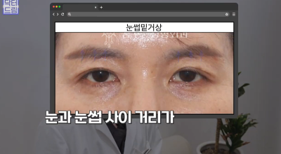 40대를 기준으로 얼굴에도 노후계획이 필요합니다 사진 18