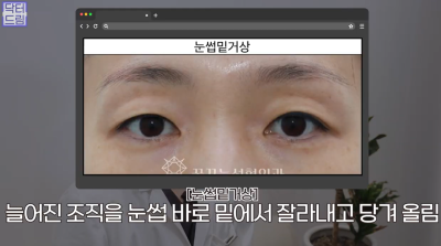 40대를 기준으로 얼굴에도 노후계획이 필요합니다 사진 15