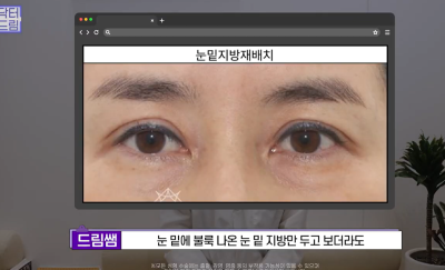 40대를 기준으로 얼굴에도 노후계획이 필요합니다 사진 3