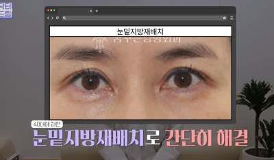 40대를 기준으로 얼굴에도 노후계획이 필요합니다 사진 4