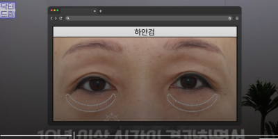 40대를 기준으로 얼굴에도 노후계획이 필요합니다 사진 5