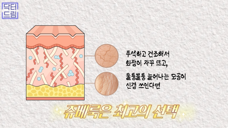 꺼진곳을 채우는, 보법이 다른 볼륨시술 원탑 쥬베룩 vs 쥬베룩볼륨