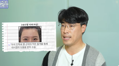 중년눈성형/눈처짐을 평정한 레전드 동안수술, 내시경이마거상 사진 15