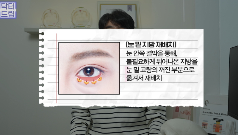 10살 늙어보이는 눈밑지방, 1시간만에 말끔히 해결됩니다 사진 13