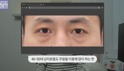 10살 늙어보이는 눈밑지방, 1시간만에 말끔히 해결됩니다 사진 3