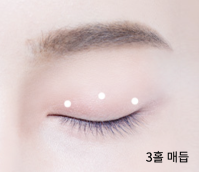 수능 끝! 강남역 자연유착 357펌라인으로 나에게 어울리는 쌍꺼풀 만들기, 대학생 새내기 첫 성형 사진 3
