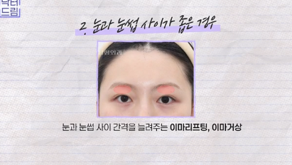윗집 아줌마 쌍꺼풀 망했다며? 중년쌍꺼풀은 따로 있는데 아가씨들 하는걸 했대.. 사진 14