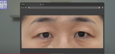 윗집 아줌마 쌍꺼풀 망했다며? 중년쌍꺼풀은 따로 있는데 아가씨들 하는걸 했대.. 사진 10