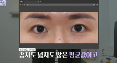 윗집 아줌마 쌍꺼풀 망했다며? 중년쌍꺼풀은 따로 있는데 아가씨들 하는걸 했대.. 사진 27