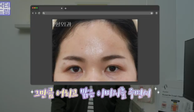 윗집 아줌마 쌍꺼풀 망했다며? 중년쌍꺼풀은 따로 있는데 아가씨들 하는걸 했대.. 사진 20