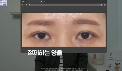 윗집 아줌마 쌍꺼풀 망했다며? 중년쌍꺼풀은 따로 있는데 아가씨들 하는걸 했대.. 사진 29
