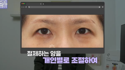 윗집 아줌마 쌍꺼풀 망했다며? 중년쌍꺼풀은 따로 있는데 아가씨들 하는걸 했대..
