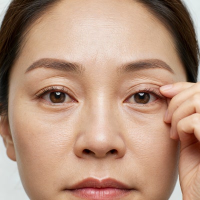중년 눈처짐, 상안검 수술만이 답일까요? 자연스럽게 눈뜨임 개선하기 강남역 꿈꾸는성형외과 사진 2