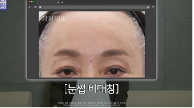 중년성형 필독! 망하는 병원 고르는 치명적 실수 3가지 사진 16