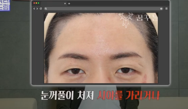 중년성형 필독! 망하는 병원 고르는 치명적 실수 3가지 사진 11
