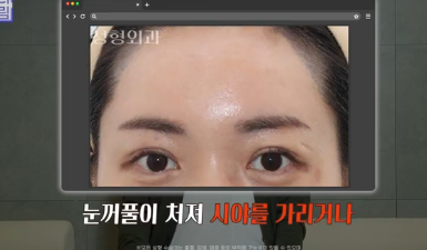 중년성형 필독! 망하는 병원 고르는 치명적 실수 3가지 사진 12