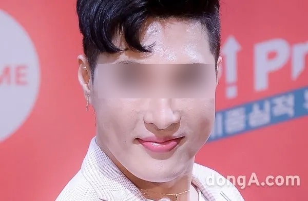 중안면 리프팅으로 동안 얼굴 만들기팔자주름·실리프팅으로 어려 보이는 인상 강남역 꿈꾸는 성형외과 사진 4