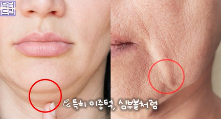 도곡동 최애레이저, 온다vs티타늄 상세분석 사진 6