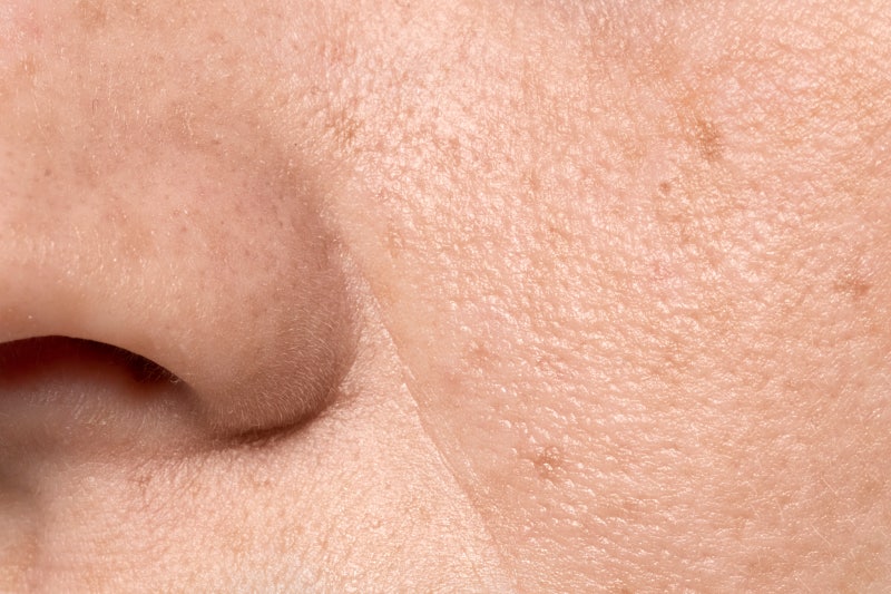 새해목표 : 한 살 더 어려 보이는 동안 만들기, 강남역 성형외과 추천 가성비 동안 시술 BEST 3 사진 8