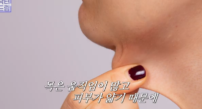 얼굴만 팽팽? 여길 보면 관리 잘 하는지 티나는거 원탑, 목주름 사진 8