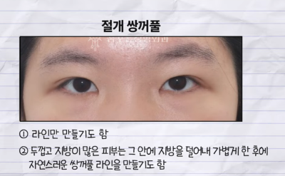 미인대회 출신 사부인 가볍게 밟아버린 중년동안수술 사진 6