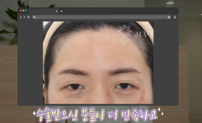 미인대회 출신 사부인 가볍게 밟아버린 중년동안수술 사진 20