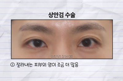 미인대회 출신 사부인 가볍게 밟아버린 중년동안수술 사진 7