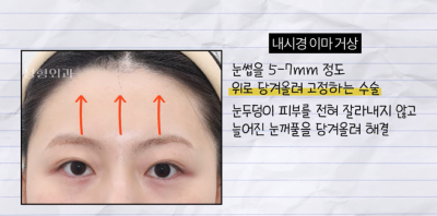 미인대회 출신 사부인 가볍게 밟아버린 중년동안수술 사진 14