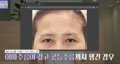 미인대회 출신 사부인 가볍게 밟아버린 중년동안수술 사진 22
