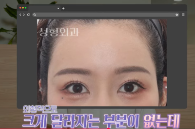 미인대회 출신 사부인 가볍게 밟아버린 중년동안수술 사진 18