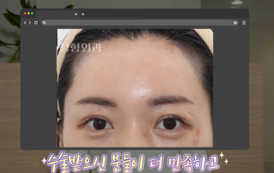 미인대회 출신 사부인 가볍게 밟아버린 중년동안수술 사진 19