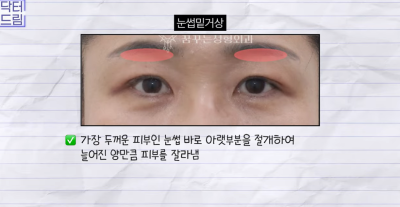 미인대회 출신 사부인 가볍게 밟아버린 중년동안수술 사진 28