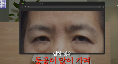 미인대회 출신 사부인 가볍게 밟아버린 중년동안수술 사진 34