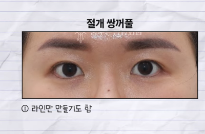 미인대회 출신 사부인 가볍게 밟아버린 중년동안수술 사진 4