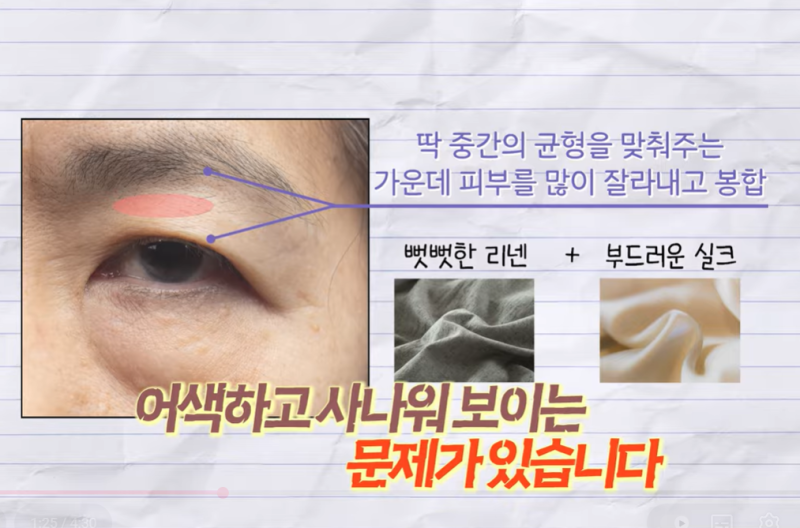 미인대회 출신 사부인 가볍게 밟아버린 중년동안수술 사진 10