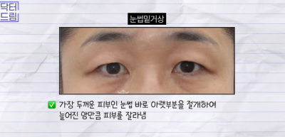 미인대회 출신 사부인 가볍게 밟아버린 중년동안수술 사진 27