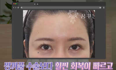 미인대회 출신 사부인 가볍게 밟아버린 중년동안수술 사진 17