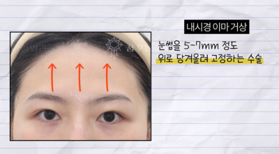 미인대회 출신 사부인 가볍게 밟아버린 중년동안수술 사진 13