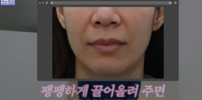 이번 명절 선물은 며느리 몰래 젊어지는 중년성형으로 하세요 사진 15