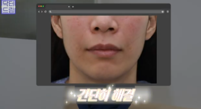 이번 명절 선물은 며느리 몰래 젊어지는 중년성형으로 하세요 사진 16
