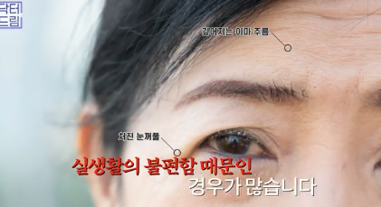 이번 명절 선물은 며느리 몰래 젊어지는 중년성형으로 하세요 사진 5